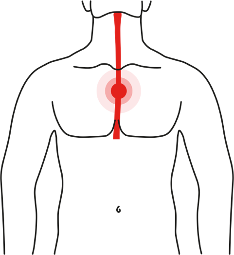 Icon of a person suffering from heatburn symptoms: burning sensation in chest and throat